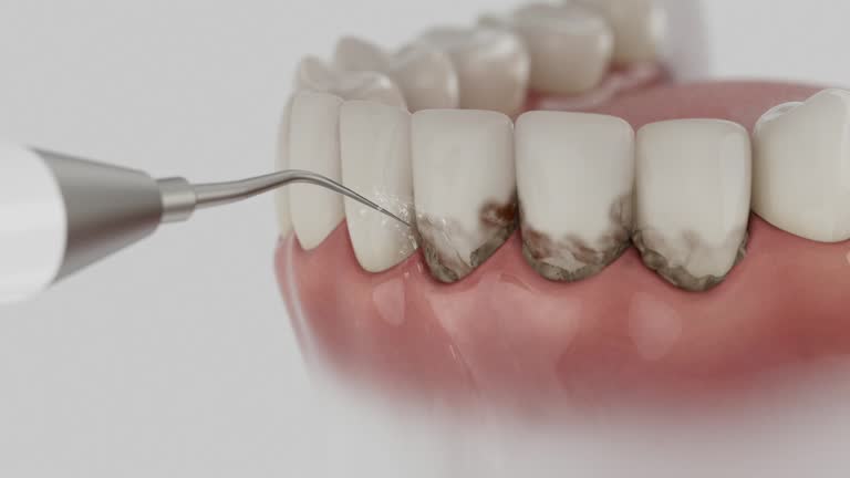 Reliable Dental contractor in Roosevelt Park, MI by Dentist Open Now
